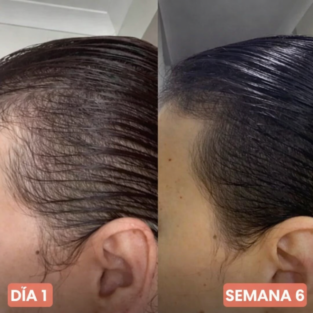 ACEITE DE SEMILLA DE CALABAZA - Detén la caída de cabello ahora!